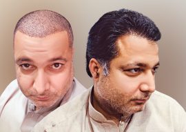 Home - Dr. Habib Cosmetic & Hair Transplant Clinic