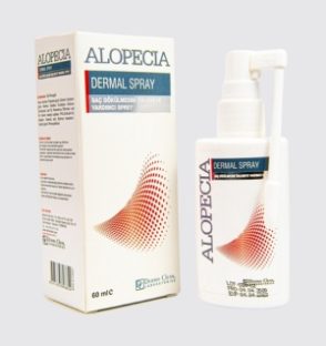Alopecia Spray